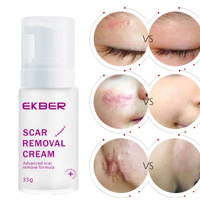 OEM Bulk Pure Natural Facial Creme Eficaz para Remoção de Cicatrizes Anti-Acne Cuidados com a Pele